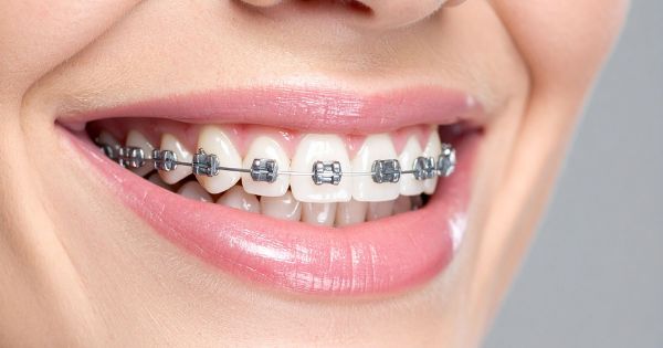 dentiahorro ortodoncia xalapa veracruz