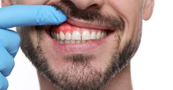 dentiahorro periodoncia xalapa veracruz